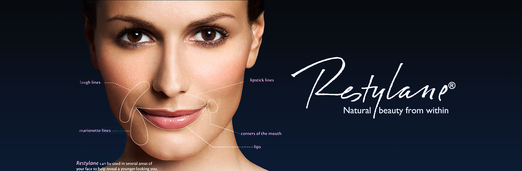 Restylane® - Natural Beauty from within